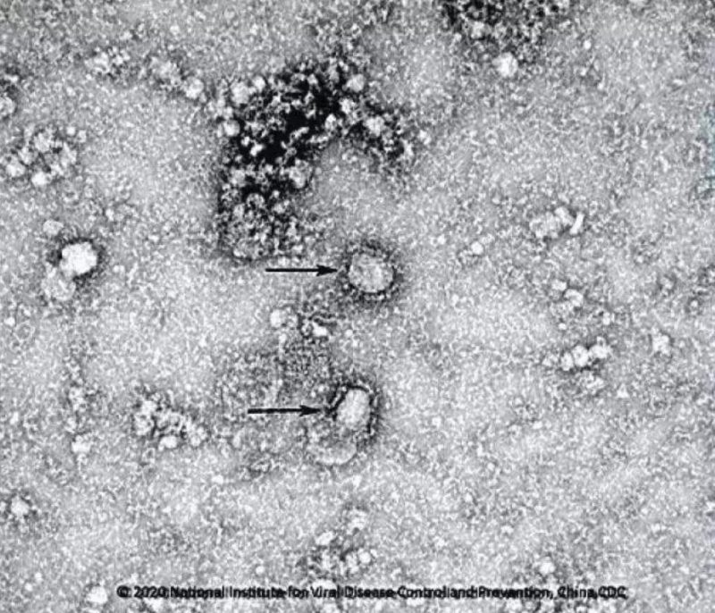 ▲新型冠狀病毒武漢株01。照片來源：國家病原微生物資源庫（中國疾病預防控制中心病毒病預防控制所）